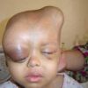 Irak_malformation_enfant_uranium-appauvri.jpg