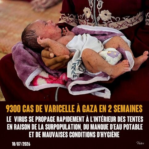 2026-07-26_Gaza_varicelle_virus-propage